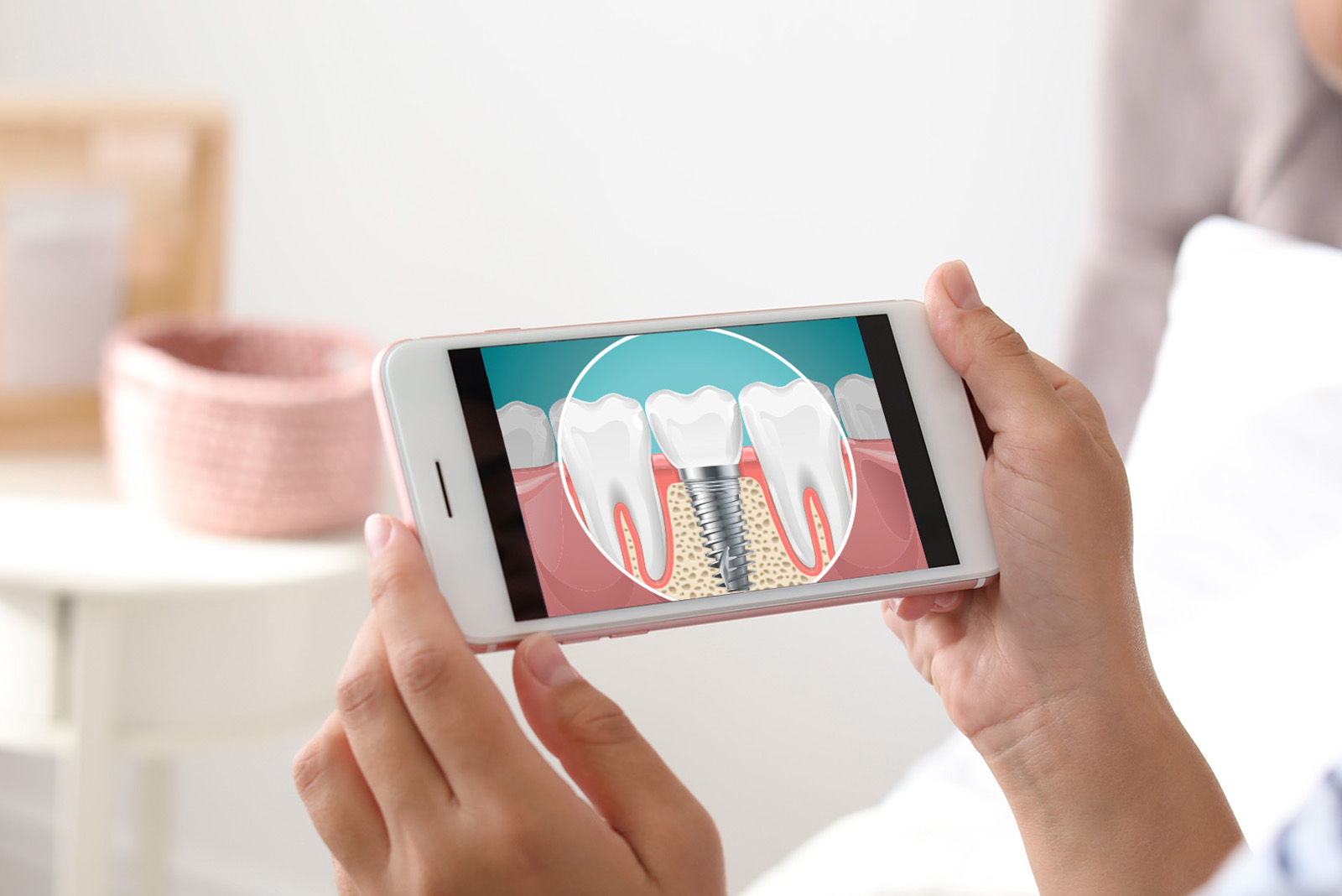All About Smiles | Sports Mouthguards, Dental Bridges and Periodontal Treatment