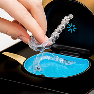 The image shows a person s hand holding a clear dental retainer with blue toothpaste inside it.