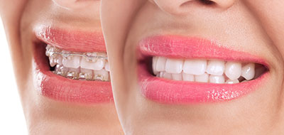 All About Smiles | Veneers, Periodontal Treatment and Oral Exams