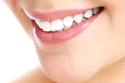 All About Smiles | CEREC, Extractions and Dental Bridges