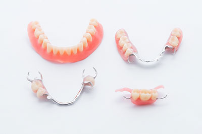 All About Smiles | Extractions, CEREC and Dental Fillings